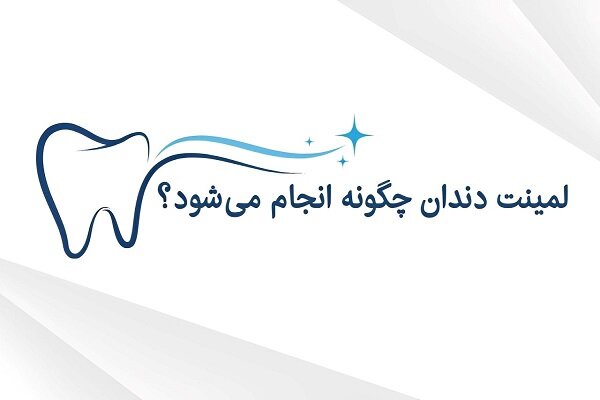 دندان،رنگ،سراميكي،غذاهاي،معمولاً،زيبايي،طراحي،مواد،مشكلات،كام ...