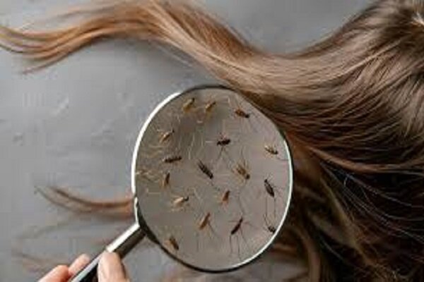 افزایش رصد مدارس همدان با هدف پیشگیری از شپش سر؛آموزش ضروری است