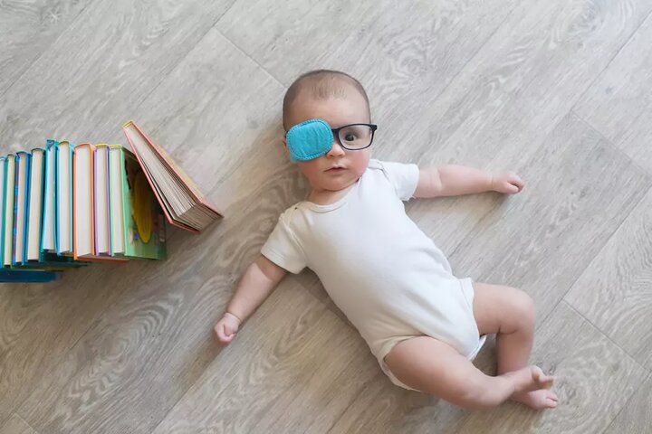 زمان طلایی تشخیص تنبلی چشم زمان طلایی تشخیص تنبلی چشم