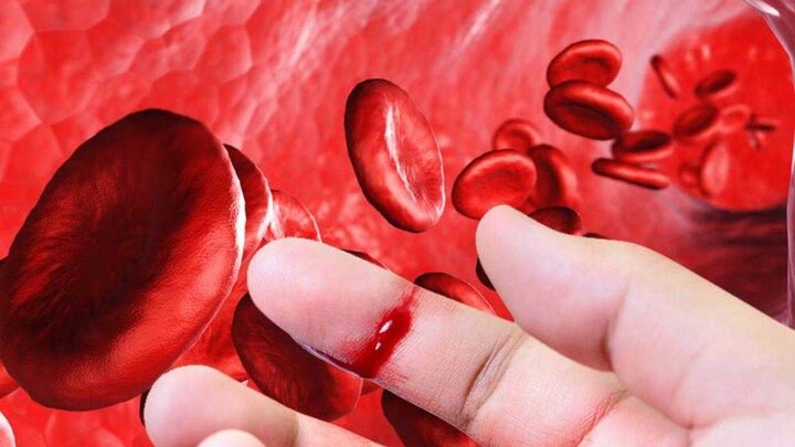 هموفیلی را بیشتر بشناسیم، از علائم تا کنترل بیماری هموفیلی را بیشتر بشناسیم، از علائم تا کنترل بیماری