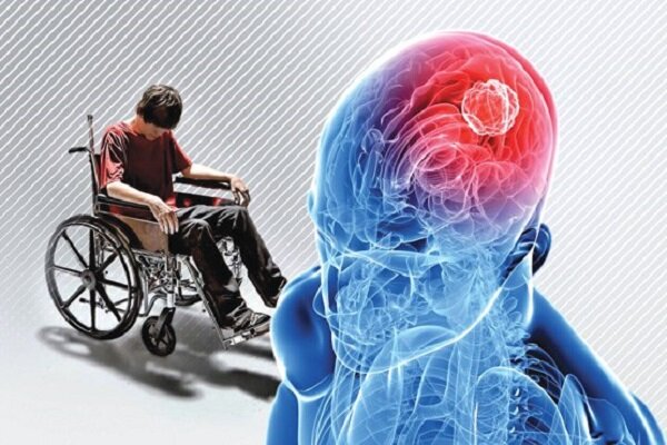 اماس؛ بیماری جوانان با ۱۰ نشانه خاموش