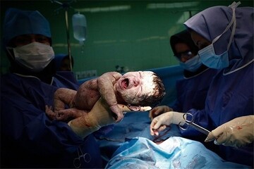 چالش نرخ بالای سزارین در گیلان؛ تقویت نقش ماماها ضرورت دارد