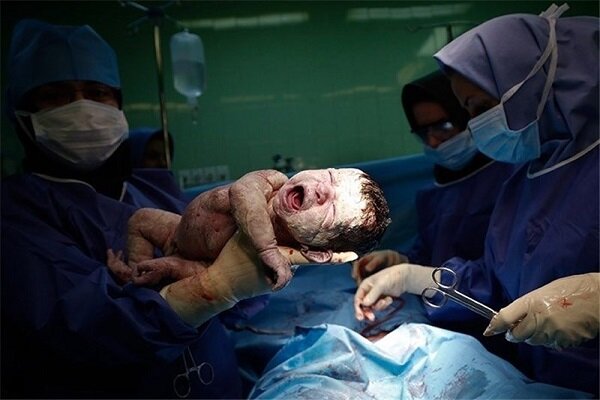 چالش نرخ بالای سزارین در گیلان؛ تقویت نقش ماماها ضرورت دارد چالش نرخ بالای سزارین در گیلان؛ تقویت نقش ماماها ضرورت دارد