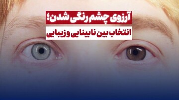 آرزوی چشم رنگی شدن؛ انتخاب بین نابینایی و زیبایی