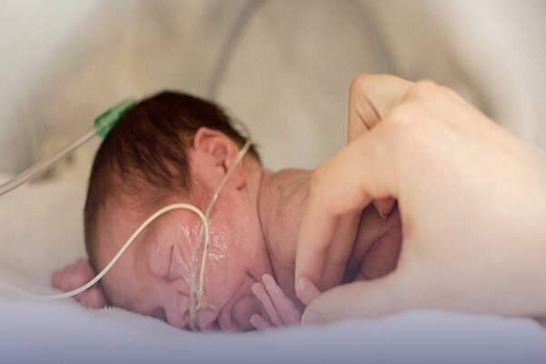 همه چیز درباره زردی نوزاد؛ ۶۰ درصد نوزادان زردی را تجربه میکنند همه چیز درباره زردی نوزاد؛ ۶۰ درصد نوزادان زردی را تجربه میکنند