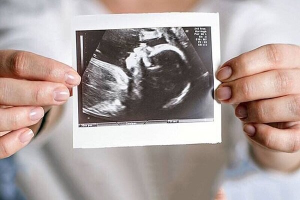 یک روز همراه با زوج‌های نابارور دربیمارستان بنت الهدی؛ در آرزوی فرزند