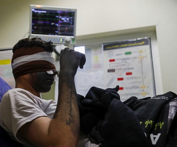 امروز ۳۱ نفر بر اثر حوادث چهارشنبه آخر سال مصدوم شدند