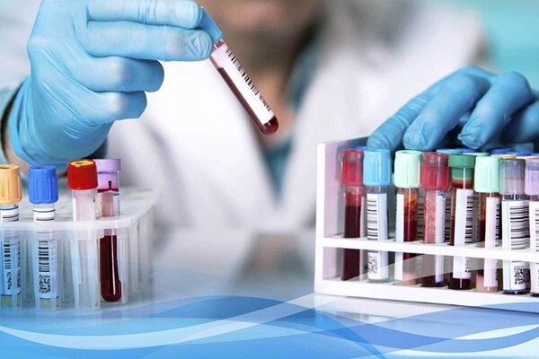 تحول در شبکه آزمایشگاهی کشور