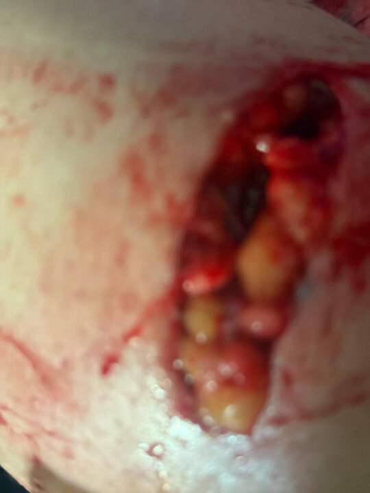 شب تلخ لواسان؛ حمله سگ لاکچری بدون قلاده به یک شهروند