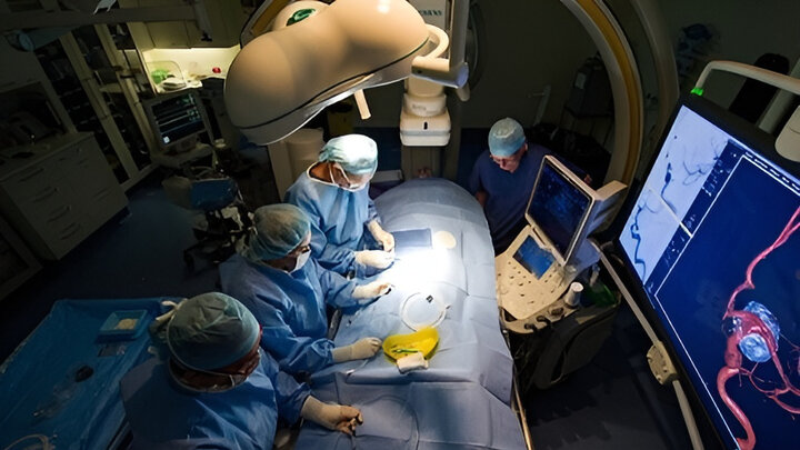 Iranian hospital uses angiography tech. for brain treatment