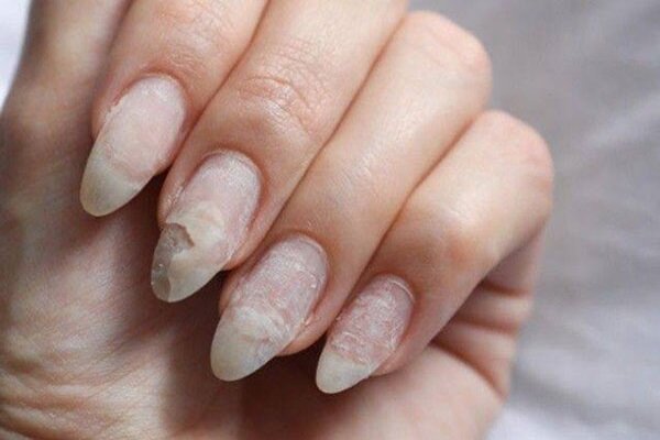 تغییر رنگ ناخن‌ها نشانه چیست؟