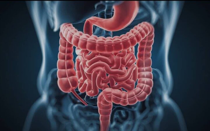 آغاز طرح ملی غربالگری سرطان روده بزرگ در بوشهر آغاز طرح ملی غربالگری سرطان روده بزرگ در بوشهر