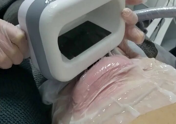 لاغری به هر قیمت؟ از جراحیهای علمی تا دام تبلیغات اینستاگرامی