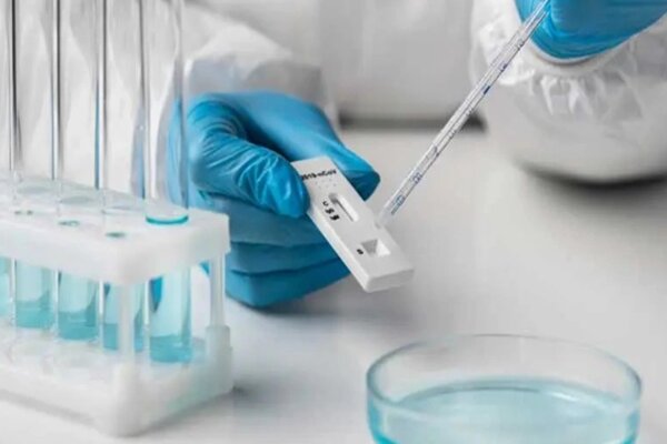 مشکلات تامین کیت‌ آزمایشگاه بیشتر شد