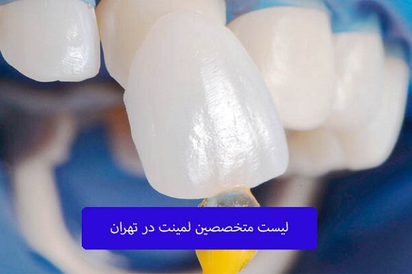 لیست متخصصین لمینت دندان در تهران