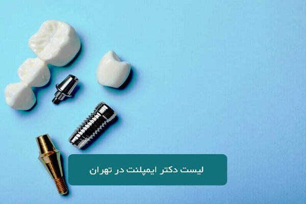 لیست متخصص ایمپلنت در تهران