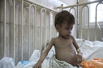 چرا راه ورود آذوقه‌ها به گرسنگان غزه را باز نمی‌کنید؟!