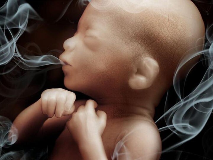آسم بیماری بیصدای قرن؛ میراث دود سیگار برای نسل آینده آسم بیماری بیصدای قرن؛ میراث دود سیگار برای نسل آینده