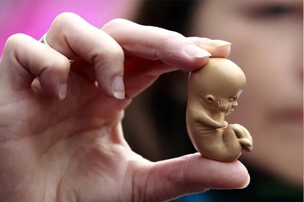 نگهداری حیوانات خانگی در بارداری، عامل افزایش ناهنجاری جنین نگهداری حیوانات خانگی در بارداری، عامل افزایش ناهنجاری جنین