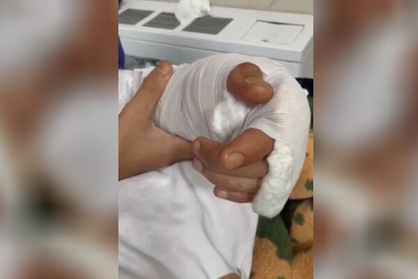 جراحي،بيمار،بيمارستان،عمومي