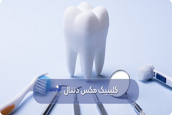 بررسی هزینههای دندان پزشکی در تهران(ویژه خدمات زیبایی دندان سال ۱۴۰۴)