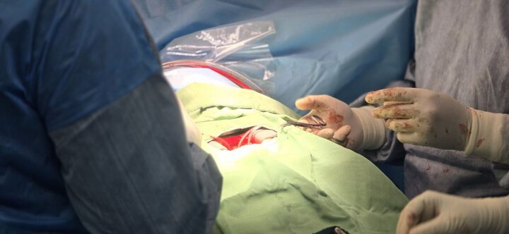 ۱۲۰۰ اهدای عضو و ۱۰۰۰ پیوند موفق در سال ۱۴۰۳ ثبت شد