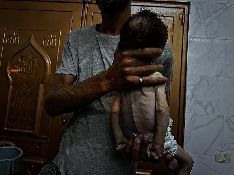 وێنەیەک جیهان شۆک دەکات؛ شەهید بوونی کۆرپەیەکی فەلەستینی بە هۆی برسیەتی