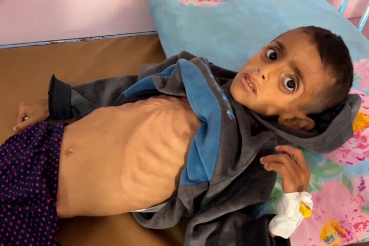 گرسنگی همچنان جان مردم غزه را میگیرد