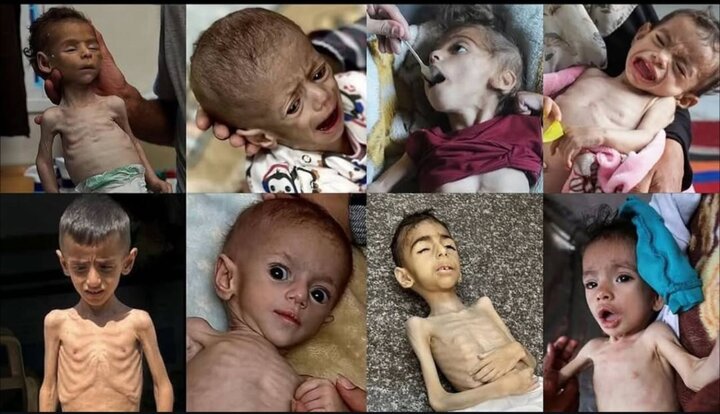 غزه در محاصره غذا، انسانیت در محاصره ادعا