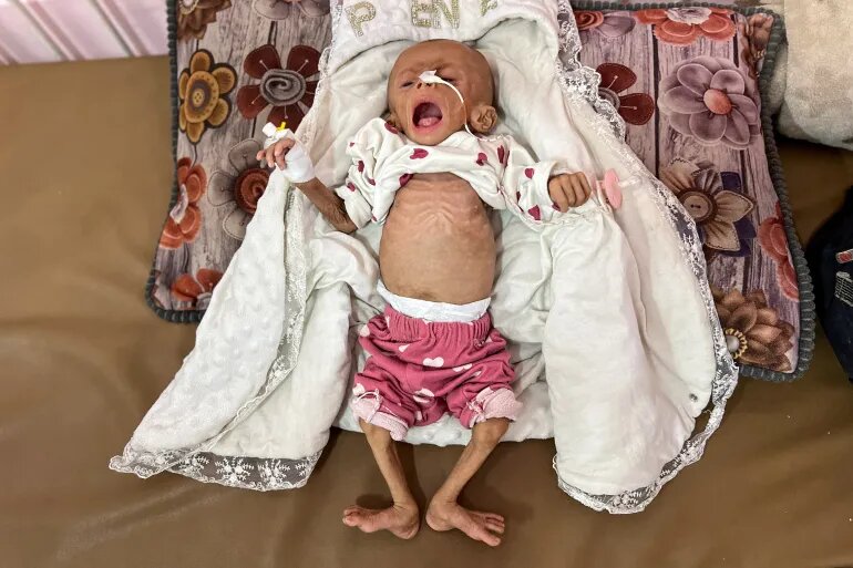 شهادت نوزاد ۶ ماهه فلسطینی بر اثر شدت گرسنگی