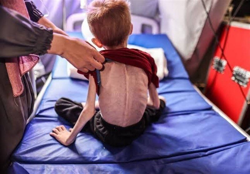 روایت تلخ شکمهای خالی و کودکانی که از گرسنگی جان میدهند روایت تلخ شکمهای خالی و کودکانی که از گرسنگی جان میدهند