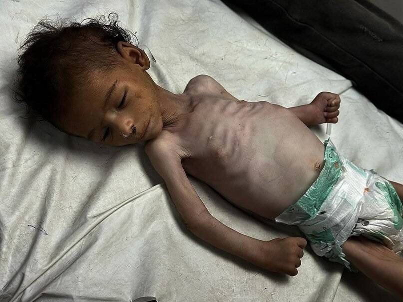 روایت تلخ شکمهای خالی و کودکانی که از گرسنگی جان میدهند روایت تلخ شکمهای خالی و کودکانی که از گرسنگی جان میدهند