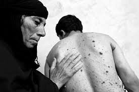 هیروشیمای ایران هنوز میسوزد؛ زرده، بایگانیِ دردهای خاموش