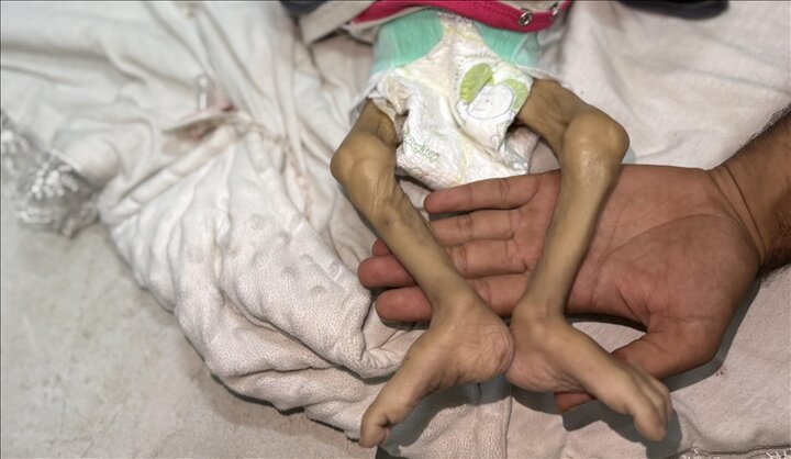 Another Palestinian infant dies from malnutrition in Gaza