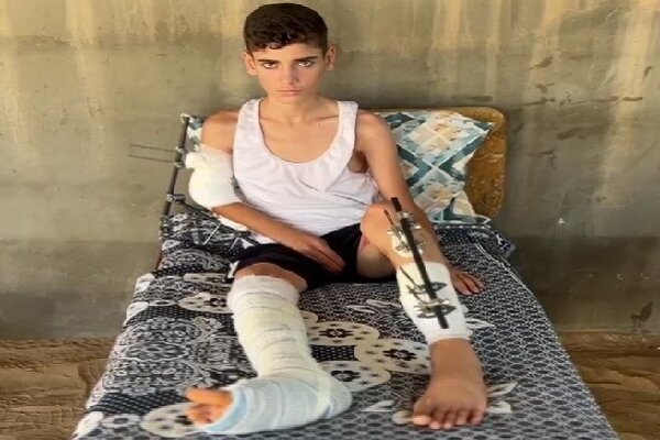 «احمد العبادله»؛ کودکی که جنگ و مورچهها در چادر مرگ او را میبلعند