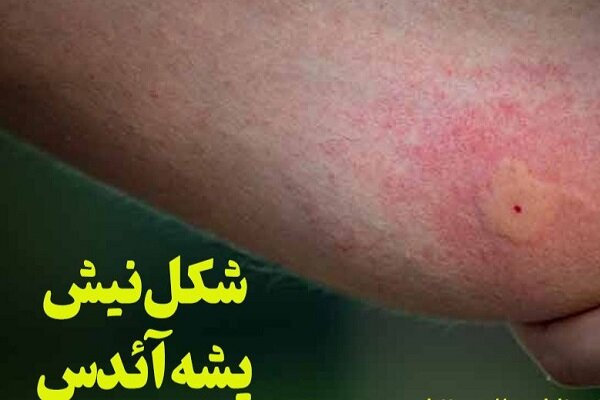 پشه آئدس معضل هرساله جنوب سیستان و بلوچستان