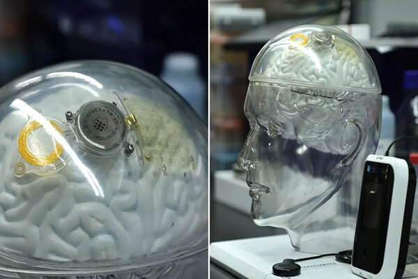 صدایی که از حنجره نمی‌آید!