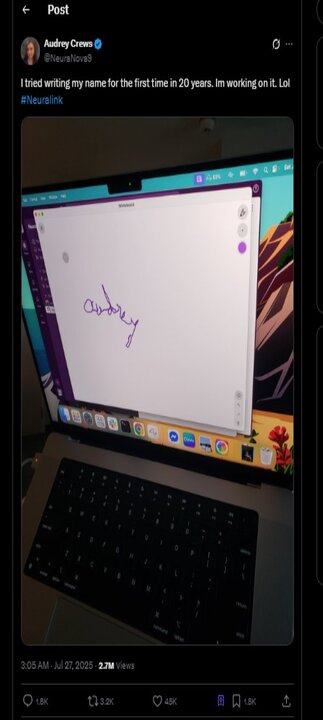 زن معلول با کمک تراشه نورالینک نامش را نوشت