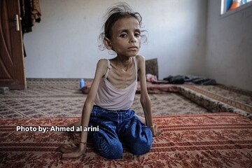 لاقەکانی کچۆڵەیەکی 9 ساڵانەی غەزە بە هۆی برسێتی، گۆ ناکەن+ وێنە