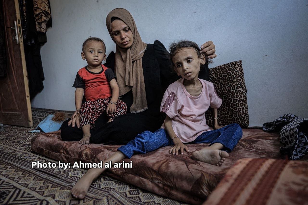 Nine-year-old Palestinian girl unable to walk due to severe malnutrition
