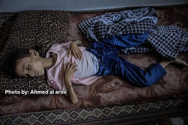 nine-year-old palestinian girl unable to walk due to severe malnutrition
