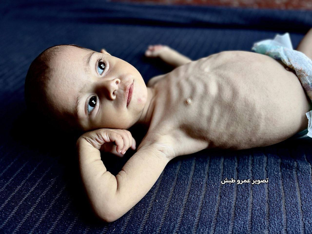 شهادت یک نوزاد فلسطینی و مرگ تدریجی نوزادی دیگر در غزه+ تصاویر
