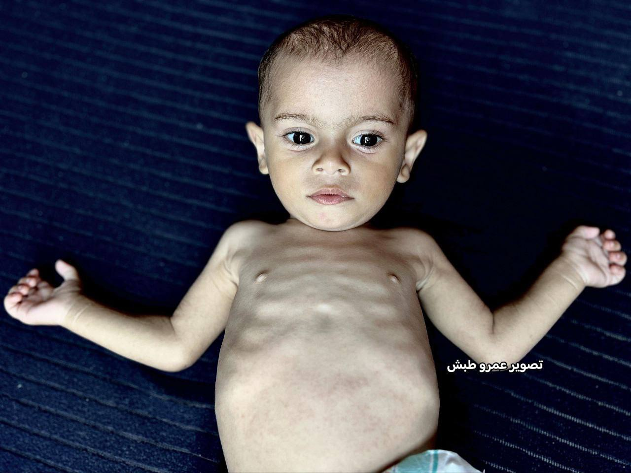 Martyrdom of a Palestinian infant and gradual death of another newborn in Gaza