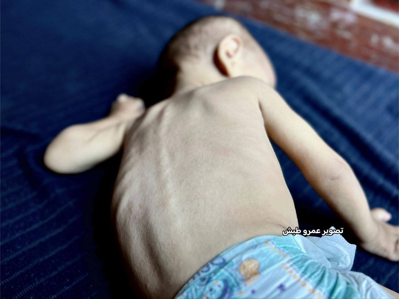 Martyrdom of a Palestinian infant and gradual death of another newborn in Gaza