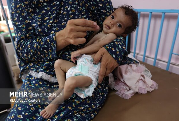 افزایش شمار شهدای قحطی و سوءتغذیه در غزه به ۱۹۷ نفر