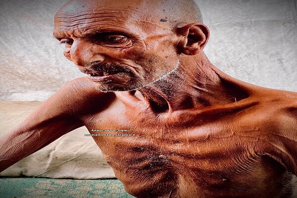 آنچه گرسنگی بر سر «سلیم عصفور» موذن مسجد صحابه غزه آورده است