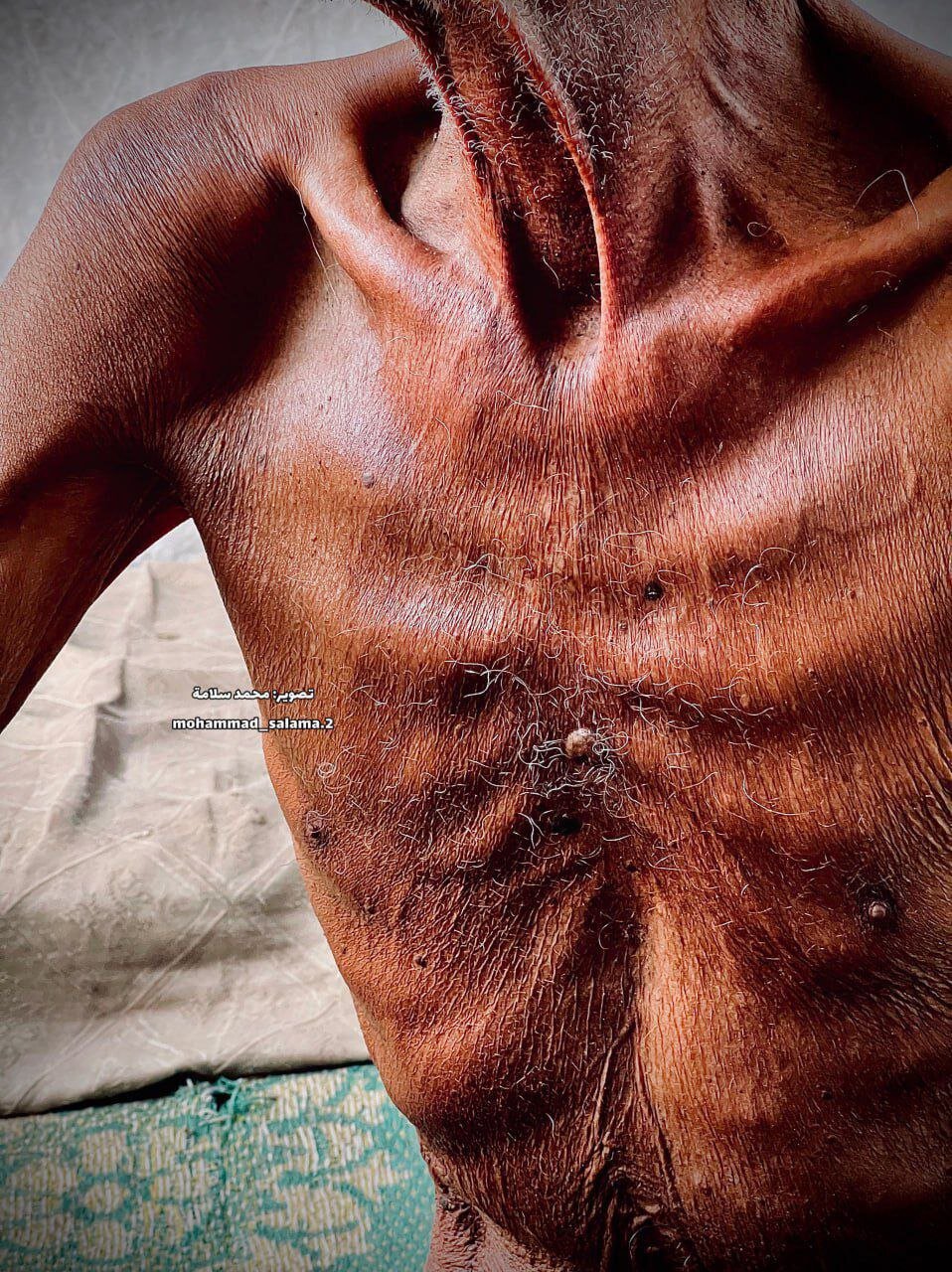 برسێتی چی بە بیلالی مزگەوتی سەحابەی غەزە کردووە+وێنەکان