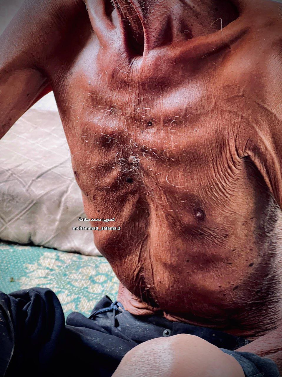 Gazze'de açlığın izleri; Sahabe Camii müezzininin dramatik durumu