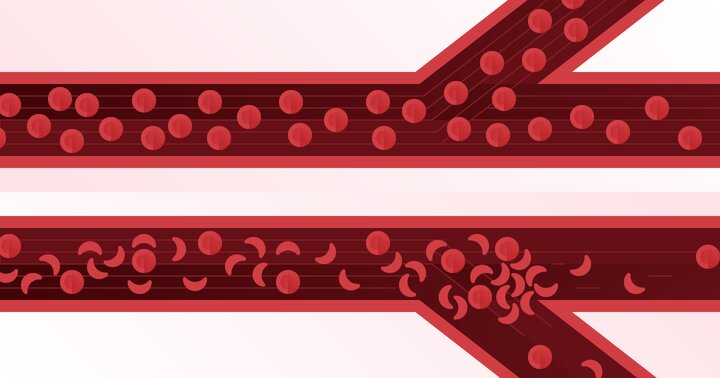 مشاوره ژنتیک راه پیشگیری ازبیماری پرهزینه سلول داسی شکل است مشاوره ژنتیک راه پیشگیری ازبیماری پرهزینه سلول داسی شکل است