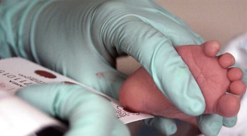 مشاوره ژنتیک راه  پیشگیری ازبیماری پرهزینه سلول داسی شکل است